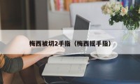 梅西被切2手指（梅西摇手指）